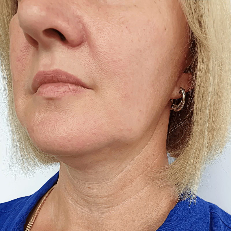 earth tech (27) earth tech (27)